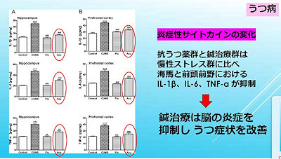 令和５年度 ９月度霊枢勉強会・学術講習会報告